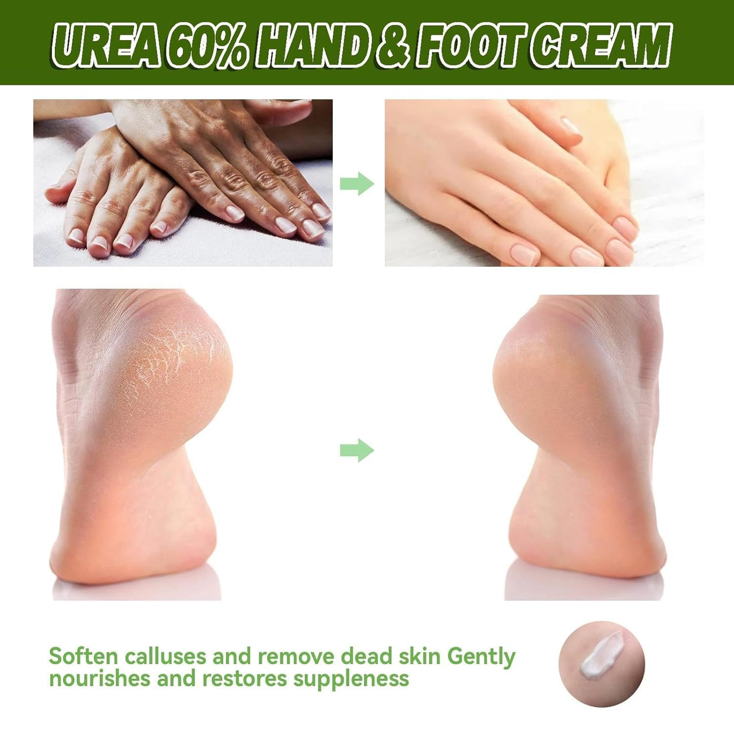 Hydrating and Anti-Cracking Foot Cream, Aktualisierung Feuchtigkeitsspendende Und Anti-Riss-Fußcreme, Fußpflegecreme Lindert Extreme Trockenheit Und Rissbildung Der Füße