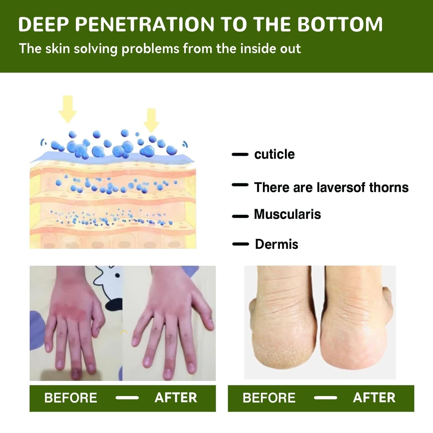 Hydrating and Anti-Cracking Foot Cream, Aktualisierung Feuchtigkeitsspendende Und Anti-Riss-Fußcreme, Fußpflegecreme Lindert Extreme Trockenheit Und Rissbildung Der Füße